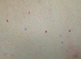 pinpoint red dots on skin stomach